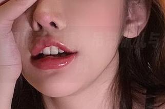 微密圈 – 图说于芷晴，吊带袜儿与想象的交融